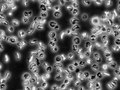 File:-Globin-Sleeping-Beauty-Transposon-Reduces-Red-Blood-Cell-Sickling-in-a-Patient-Derived-CD34+-Based-pone.0080403.s002.ogv