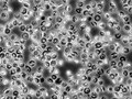 File:-Globin-Sleeping-Beauty-Transposon-Reduces-Red-Blood-Cell-Sickling-in-a-Patient-Derived-CD34+-Based-pone.0080403.s003.ogv
