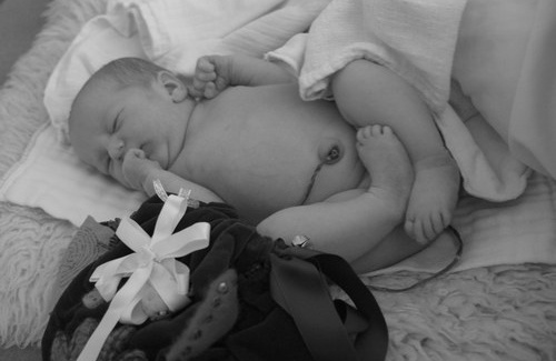 Lotus Birth, il parto dolce Lotus Birth, il parto dolce