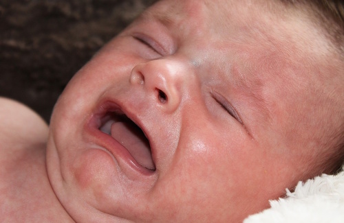L’epilessia infantile L’epilessia infantile