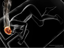 Epilessia: sintomi e trattamenti Epilessia: sintomi e trattamenti