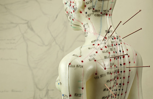 L'agopuntura nell'ansia L'agopuntura nell'ansia