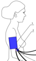 A D1.png